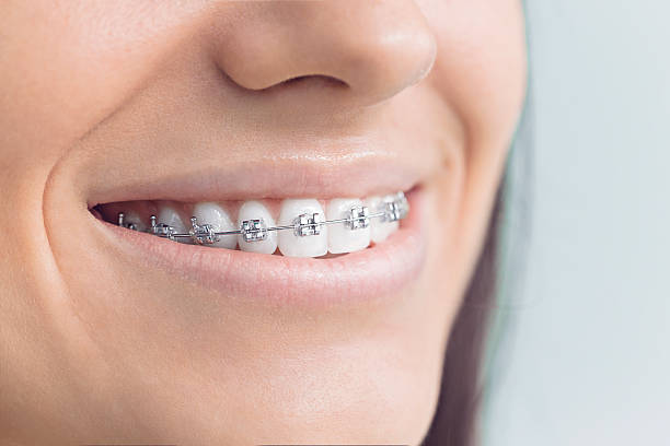 Best Teeth Whitening  in Warrington, FL